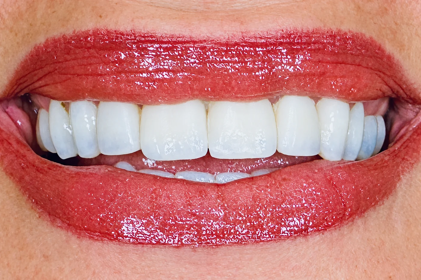 Close-up of a bright white smile