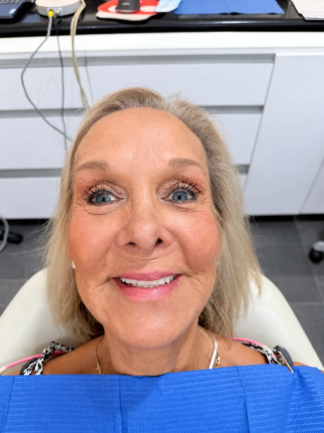 All-on-6 patient showing new smile after treatment