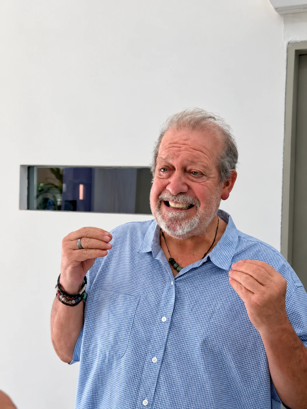 All-on-6 patient showing new smile after treatment